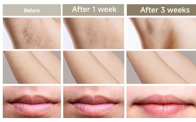Permanent IPL Laser Epilator Women's Depilators Facial Shaving Hair Cutting Machine Men's Razor Shaver Mower Laser Hair Removal